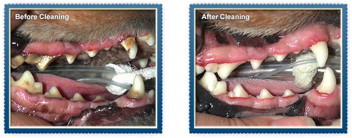 Before and After Dental Cleaning